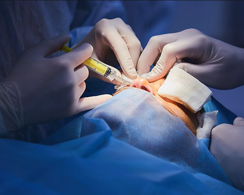 Blepharoplasty
