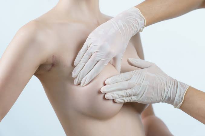 Breast Aesthetic Surgery
