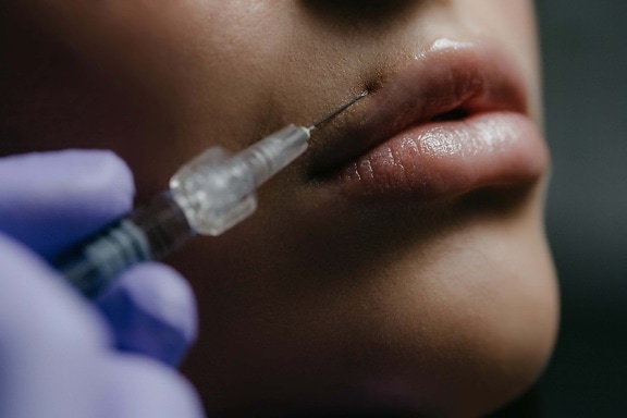Chin Implant